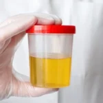 Urine Luck Because Scientists Figured Out Why Pee Is Yellow